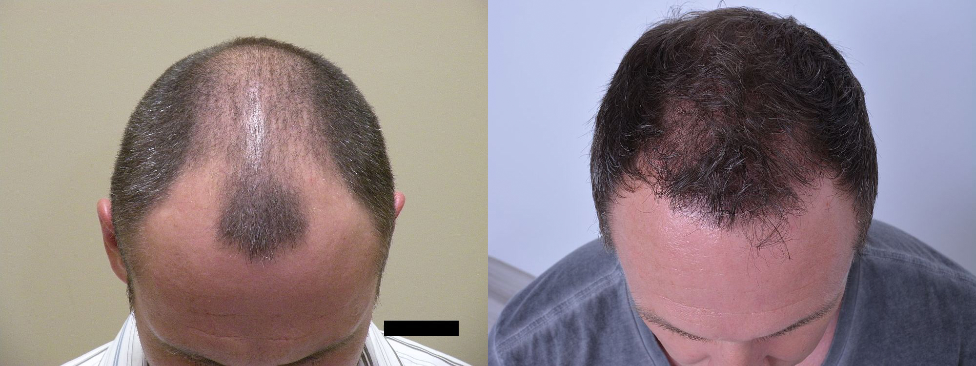 B&A1