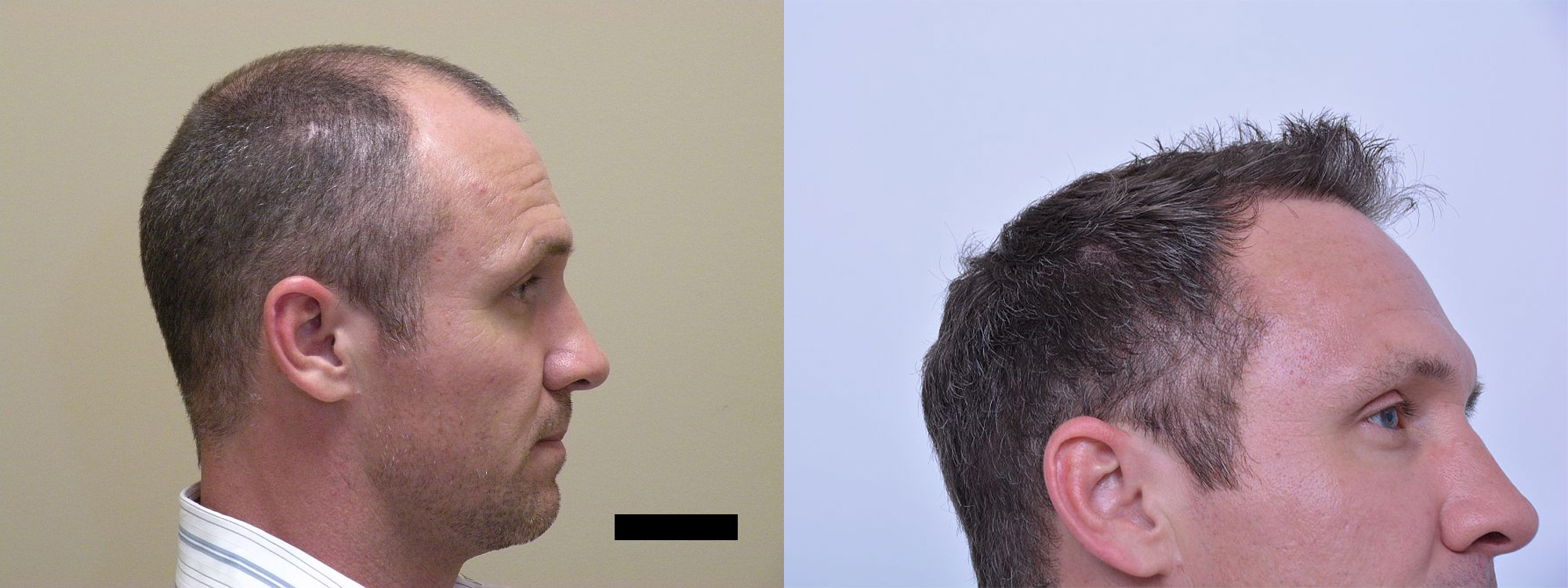 B&A2