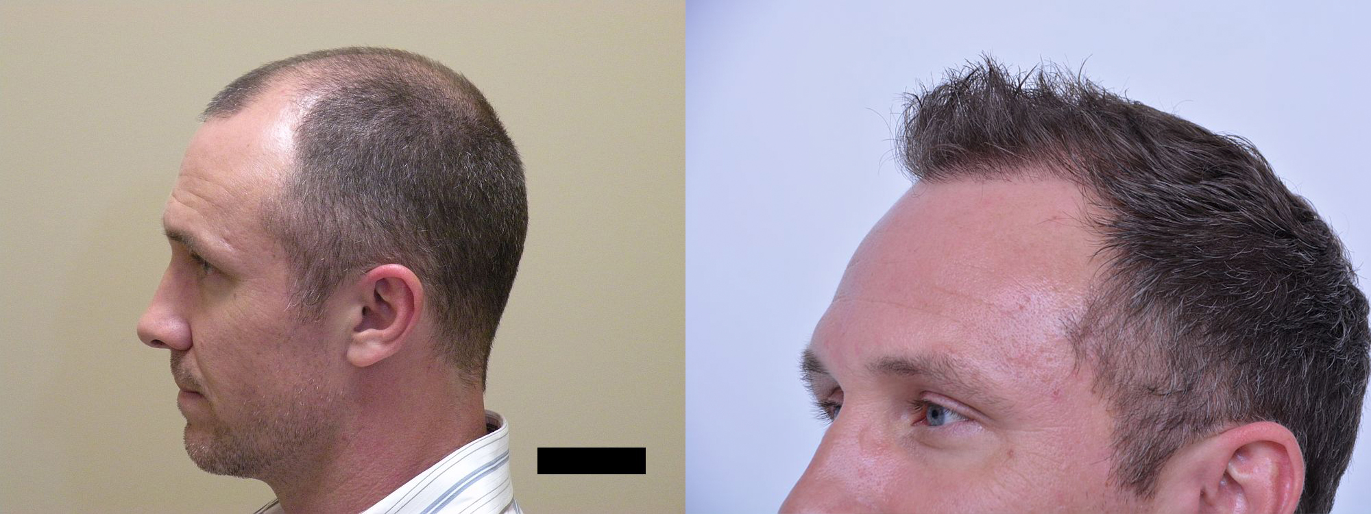B&A3