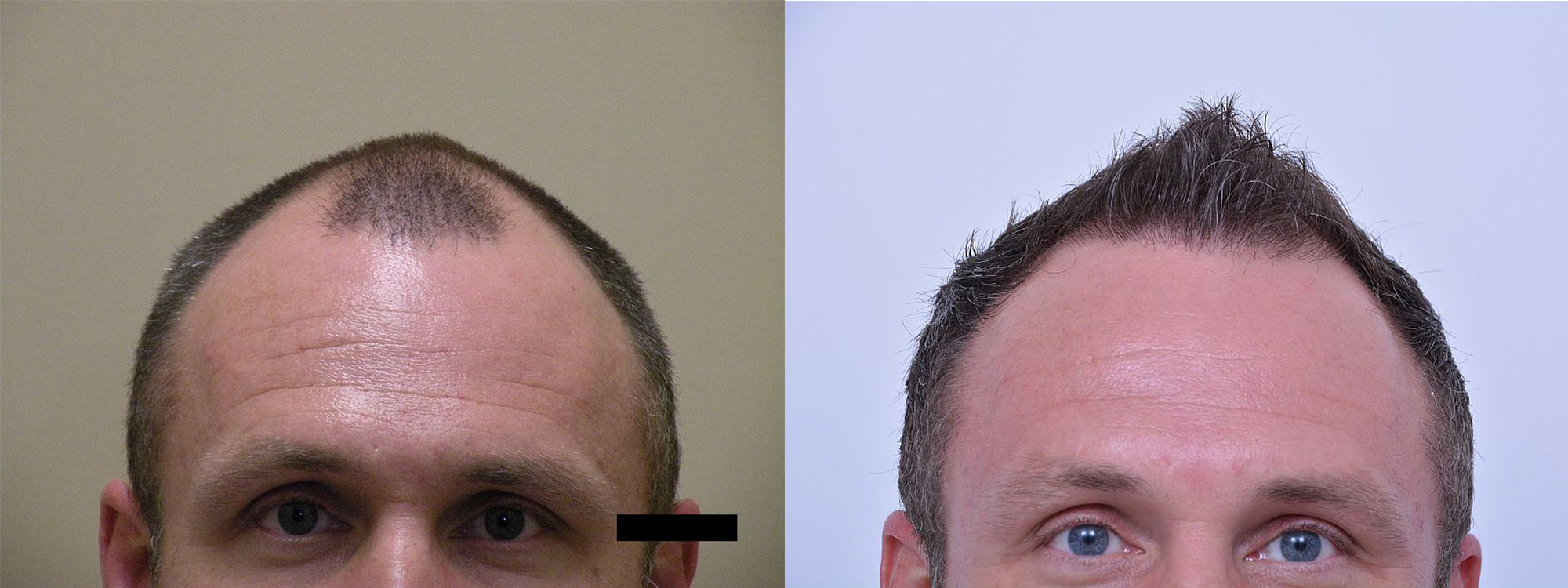 B&A4