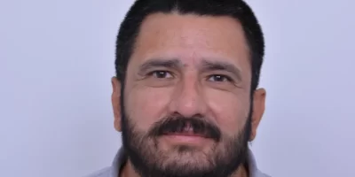beard-before-and-after-patient-1-b beard-before-and-after-patient-1-b
