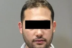 laser-therapy-before-and-after-patient-4-a laser-therapy-before-and-after-patient-4-a