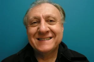 mens-before-and-after-patient-12-b mens-before-and-after-patient-12-b