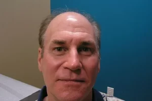 mens-before-and-after-patient-16-c mens-before-and-after-patient-16-c