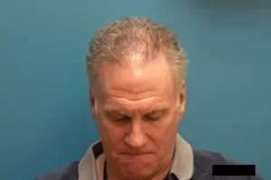 mens-before-and-after-patient-16-d mens-before-and-after-patient-16-d