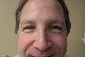 mens-before-and-after-patient-17-a mens-before-and-after-patient-17-a
