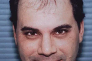 mens-before-and-after-patient-23-a mens-before-and-after-patient-23-a