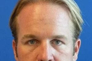 mens-before-and-after-patient-27-b mens-before-and-after-patient-27-b