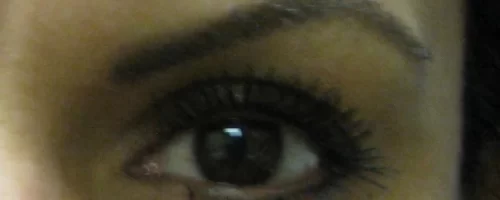 patient-1-eyebrow-transplant-f patient-1-eyebrow-transplant-f