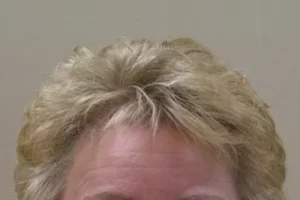 womens-before-and-after-patient-3-b womens-before-and-after-patient-3-b