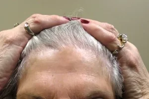womens-before-and-after-patient-4-b womens-before-and-after-patient-4-b