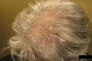 womens-before-and-after-patient-4-d womens-before-and-after-patient-4-d