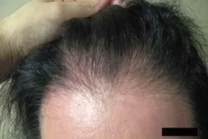 womens-before-and-after-patient-5-g womens-before-and-after-patient-5-g