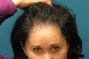 womens-before-and-after-patient-5-h womens-before-and-after-patient-5-h