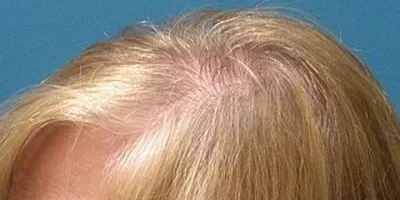 womens-before-and-after-patient-6-d womens-before-and-after-patient-6-d