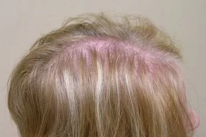 womens-before-and-after-patient-6-e womens-before-and-after-patient-6-e