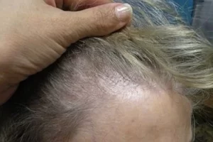 womens-before-and-after-patient-7-b womens-before-and-after-patient-7-b