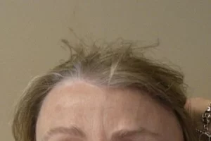 womens-before-and-after-patient-7-c womens-before-and-after-patient-7-c