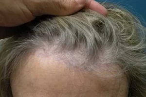 womens-before-and-after-patient-7-d womens-before-and-after-patient-7-d